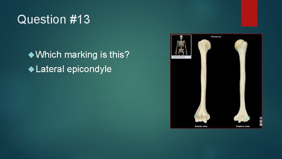 Question #13 Which marking is this? Lateral epicondyle 