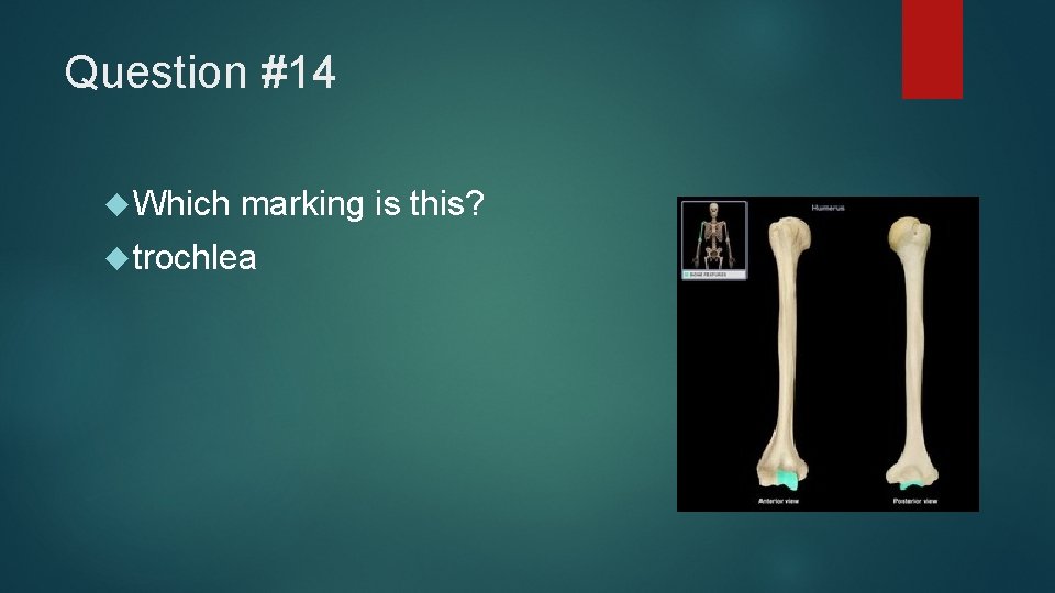 Question #14 Which marking is this? trochlea 