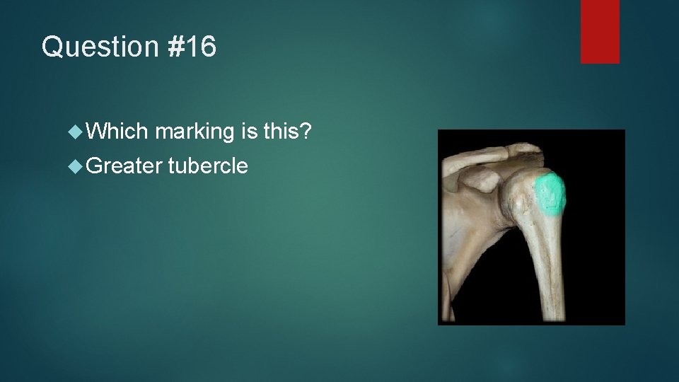 Question #16 Which marking is this? Greater tubercle 