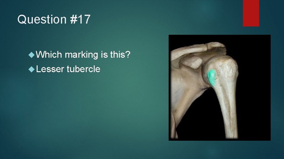 Question #17 Which marking is this? Lesser tubercle 
