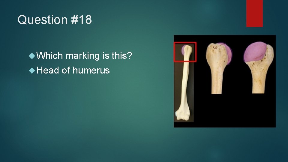 Question #18 Which Head marking is this? of humerus 
