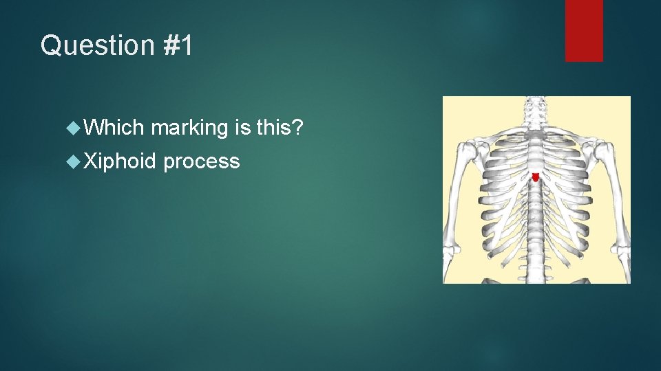 Question #1 Which marking is this? Xiphoid process 