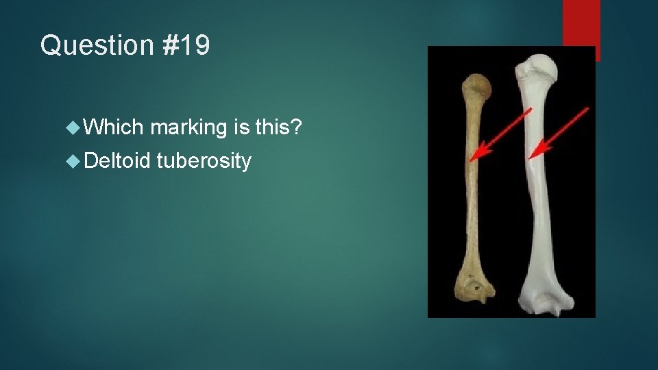 Question #19 Which marking is this? Deltoid tuberosity 