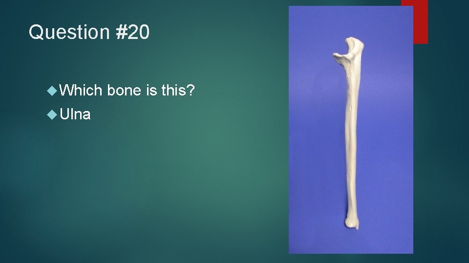 Question #20 Which Ulna bone is this? 