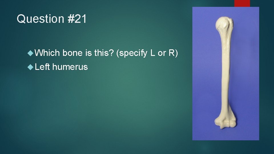 Question #21 Which Left bone is this? (specify L or R) humerus 
