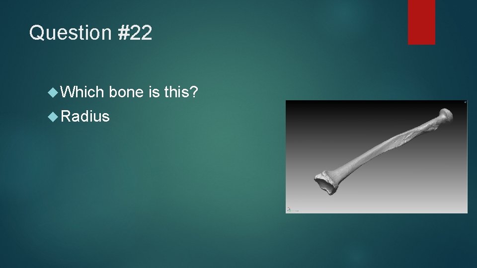 Question #22 Which bone is this? Radius 