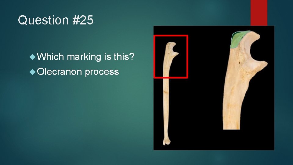 Question #25 Which marking is this? Olecranon process 