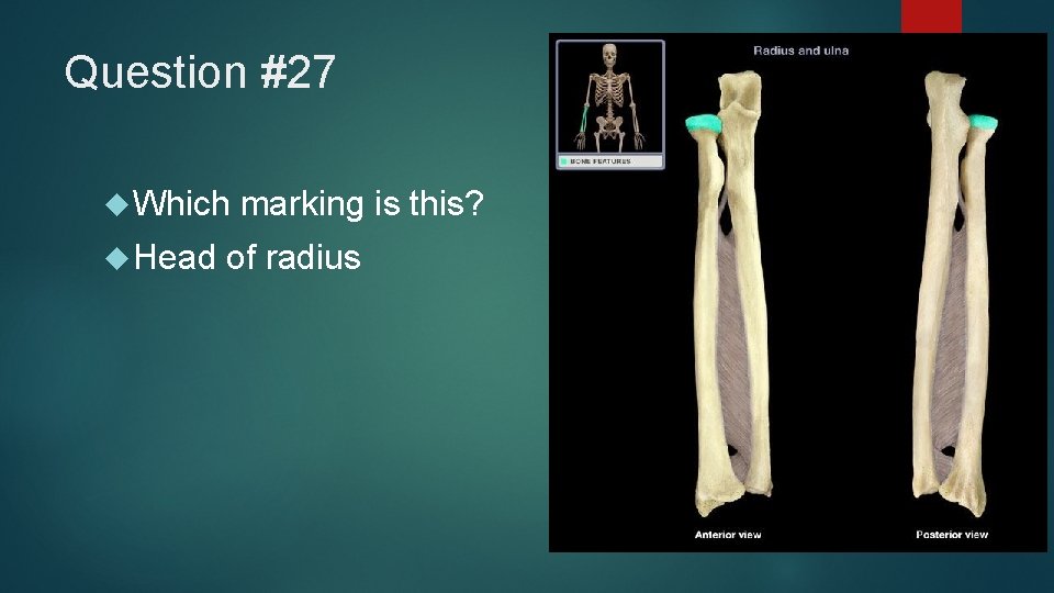 Question #27 Which Head marking is this? of radius 