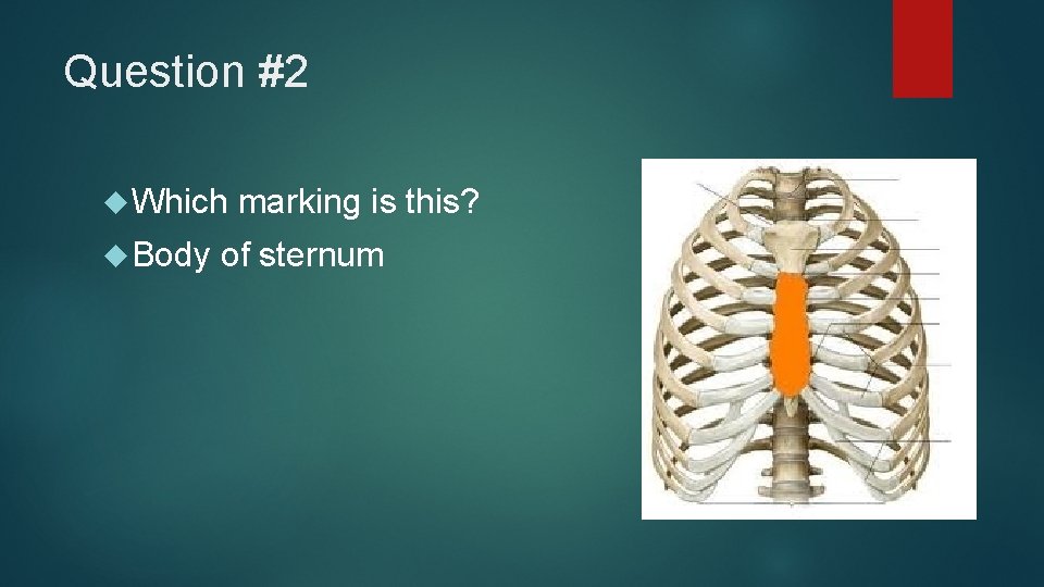 Question #2 Which Body marking is this? of sternum 