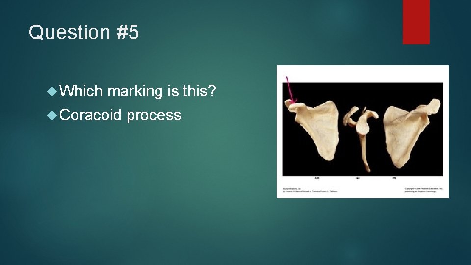 Question #5 Which marking is this? Coracoid process 