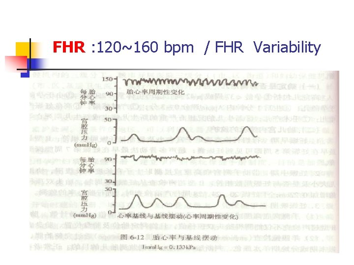 FHR : 120~160 bpm / FHR Variability 