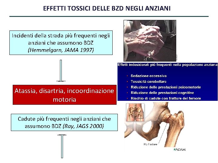 EFFETTI TOSSICI DELLE BZD NEGLI ANZIANI Incidenti della strada più frequenti negli anziani che