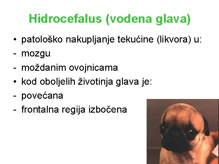 Hidrocefalus (vodena glava) • • - patološko nakupljanje tekućine (likvora) u: mozgu moždanim ovojnicama