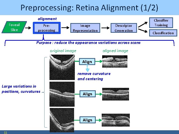 Preprocessing: Retina Alignment (1/2) alignment Foveal Slice Preprocessing Image Representation Descriptor Generation Purpose :