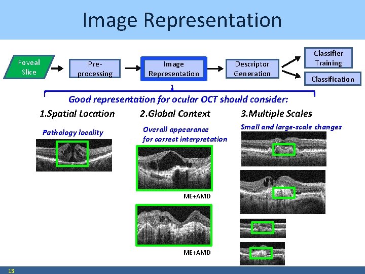 Image Representation Foveal Slice Preprocessing Image Representation Descriptor Generation Classifier Training Classification Good representation