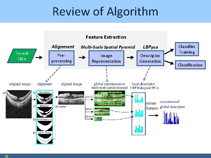Review of Algorithm Feature Extraction Alignment Foveal Slice 16 Preprocessing Multi-Scale Spatial Pyramid Image