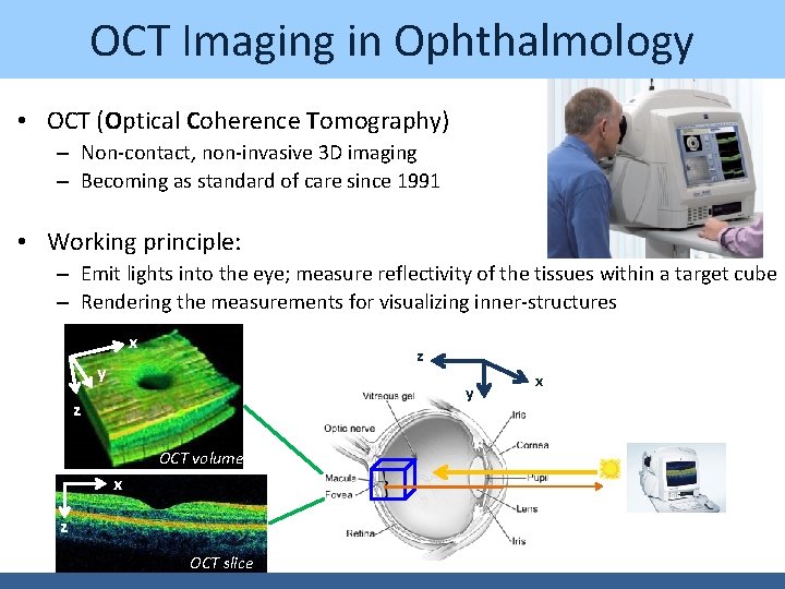 OCT Imaging in Ophthalmology • OCT (Optical Coherence Tomography) – Non-contact, non-invasive 3 D