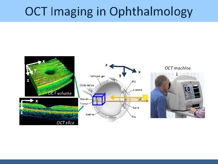 OCT Imaging in Ophthalmology x z y y z OCT volume x z OCT