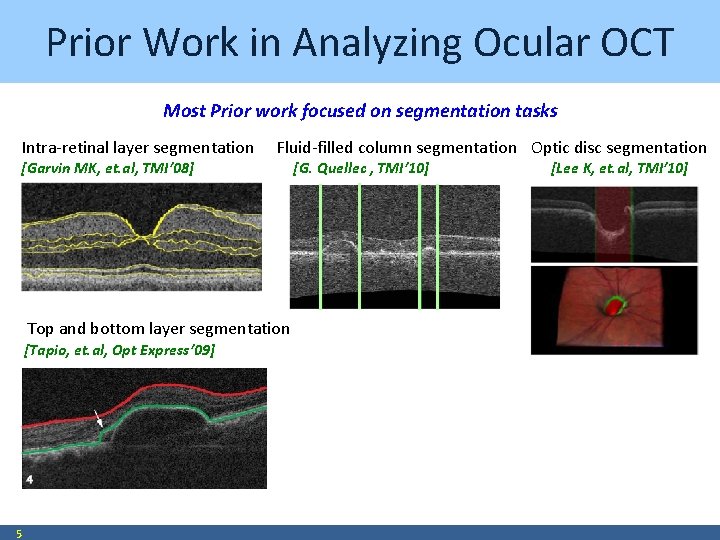Prior Work in Analyzing Ocular OCT Most Prior work focused on segmentation tasks Intra-retinal
