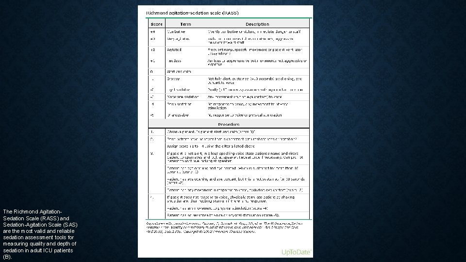 The Richmond Agitation. Sedation Scale (RASS) and Sedation-Agitation Scale (SAS) are the most valid