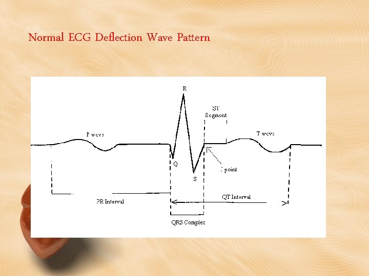 Normal ECG Deflection Wave Pattern 