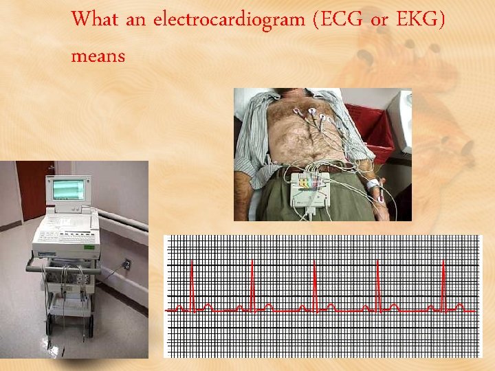 What an electrocardiogram (ECG or EKG) means 