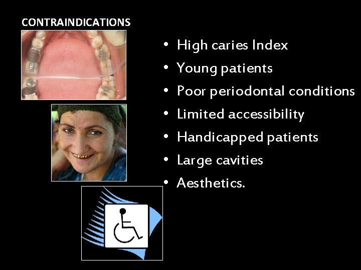 CONTRAINDICATIONS • • High caries Index Young patients Poor periodontal conditions Limited accessibility Handicapped