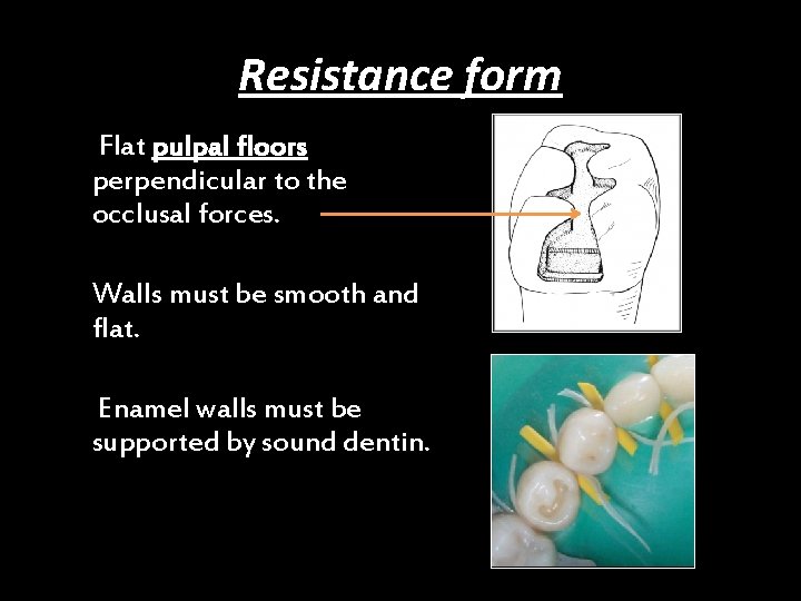 Resistance form Flat pulpal floors perpendicular to the occlusal forces. Walls must be smooth