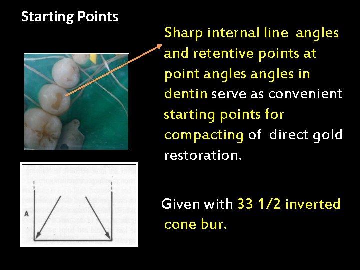 Starting Points Sharp internal line angles and retentive points at point angles in dentin