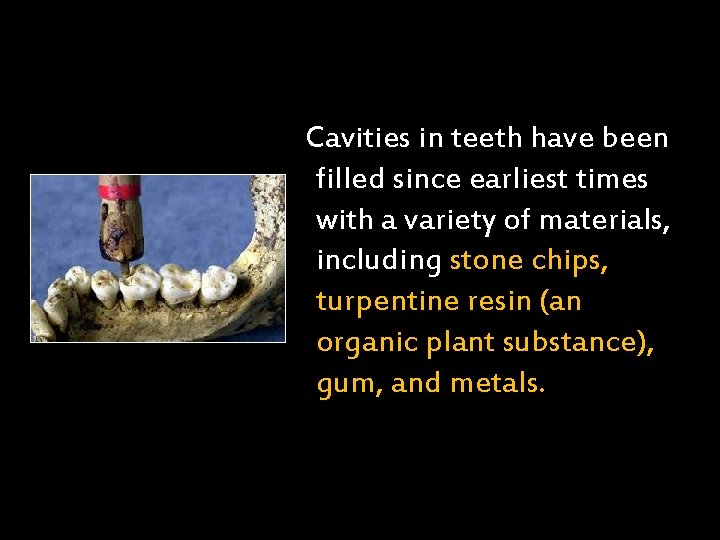 Cavities in teeth have been filled since earliest times with a variety of materials,