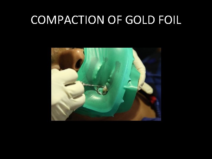 COMPACTION OF GOLD FOIL 