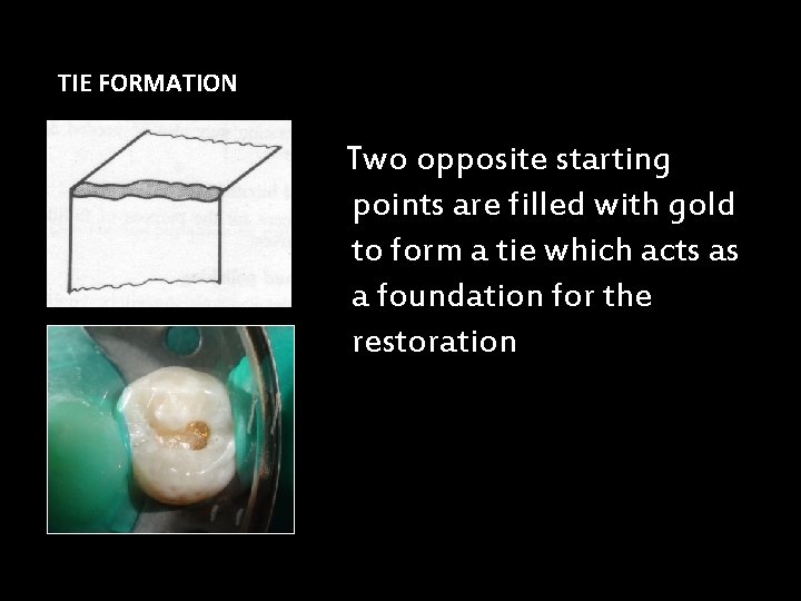 TIE FORMATION Two opposite starting points are filled with gold to form a tie