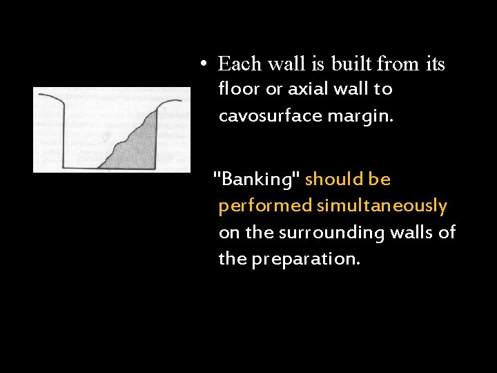  • Each wall is built from its floor or axial wall to cavosurface