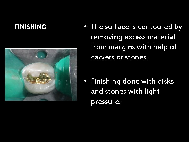 FINISHING • The surface is contoured by removing excess material from margins with help