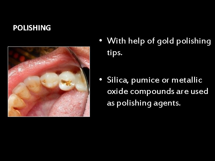 POLISHING • With help of gold polishing tips. • Silica, pumice or metallic oxide