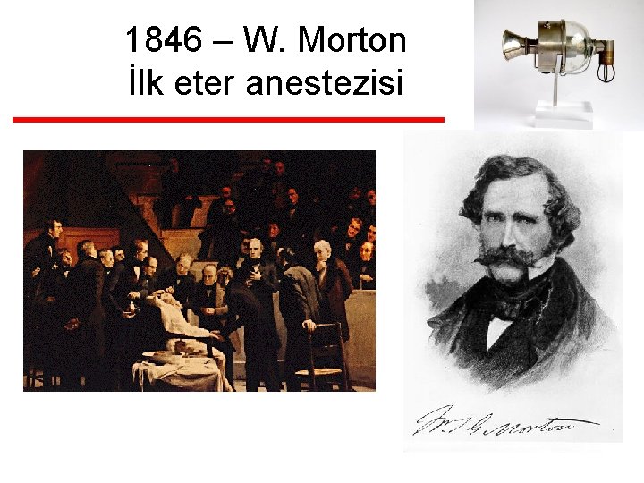 1846 – W. Morton İlk eter anestezisi 