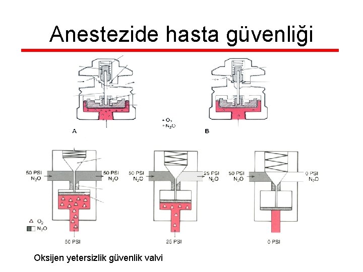 Anestezide hasta güvenliği Oksijen yetersizlik güvenlik valvi 