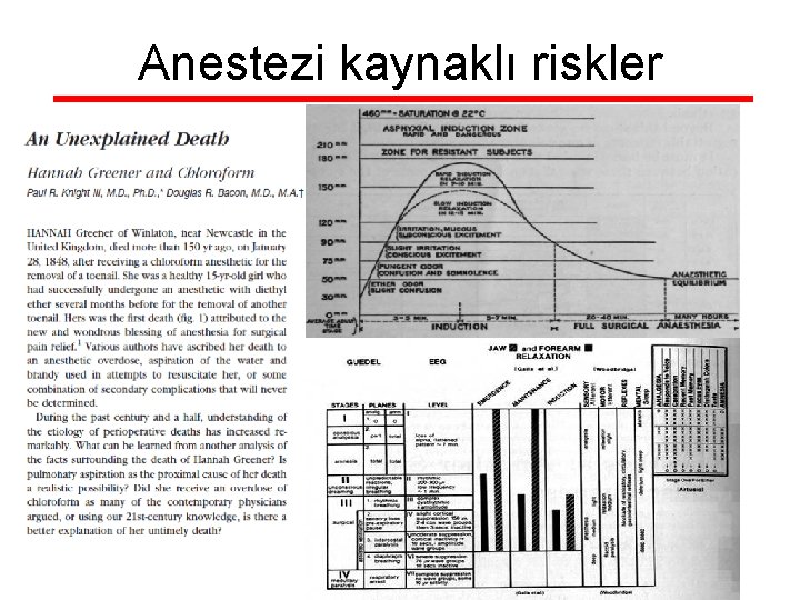 Anestezi kaynaklı riskler 