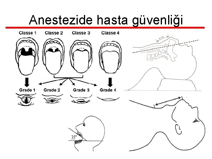 Anestezide hasta güvenliği 