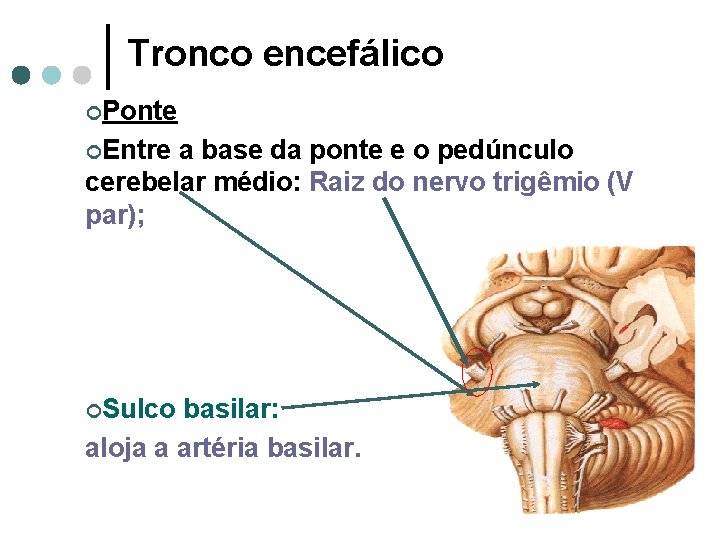 Tronco encefálico ¢Ponte ¢Entre a base da ponte e o pedúnculo cerebelar médio: Raiz