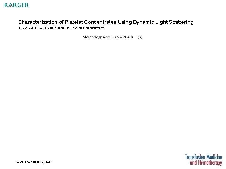 Characterization of Platelet Concentrates Using Dynamic Light Scattering Transfus Med Hemother 2013; 40: 93