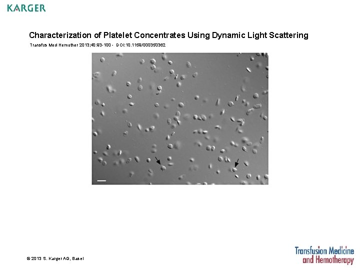 Characterization of Platelet Concentrates Using Dynamic Light Scattering Transfus Med Hemother 2013; 40: 93