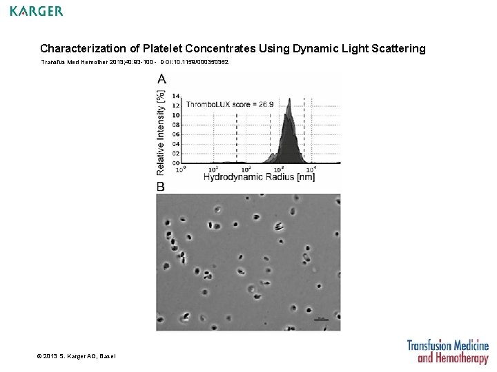 Characterization of Platelet Concentrates Using Dynamic Light Scattering Transfus Med Hemother 2013; 40: 93