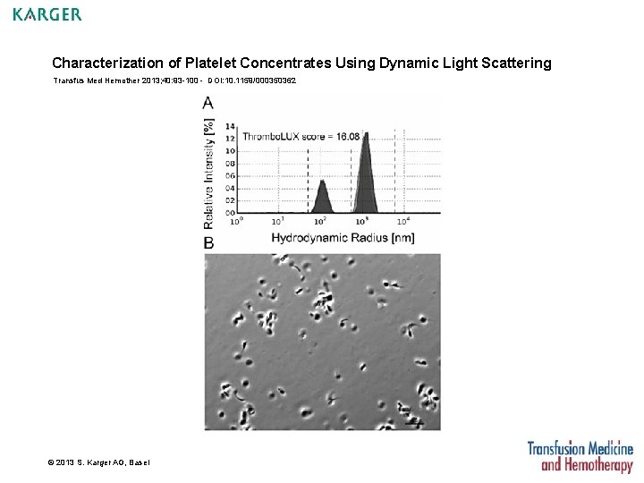 Characterization of Platelet Concentrates Using Dynamic Light Scattering Transfus Med Hemother 2013; 40: 93