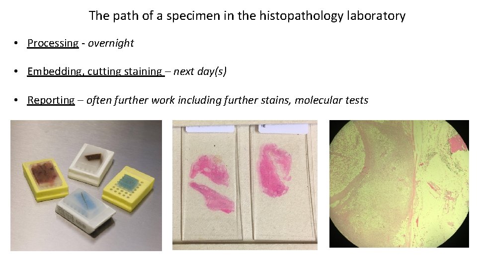 The path of a specimen in the histopathology laboratory • Processing - overnight •