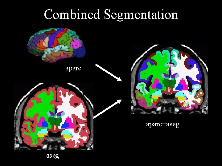 Combined Segmentation aparc+aseg 