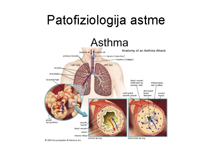 Patofiziologija astme 