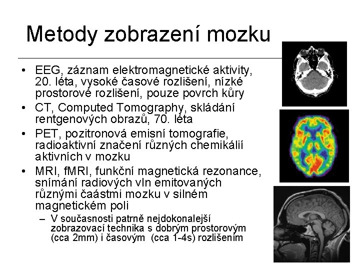 Metody zobrazení mozku • EEG, záznam elektromagnetické aktivity, 20. léta, vysoké časové rozlišení, nízké