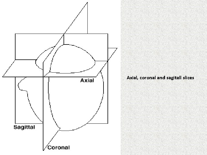 Axial, coronal and sagitall slices 