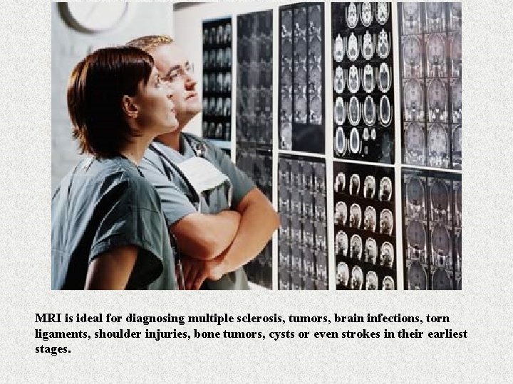 MRI is ideal for diagnosing multiple sclerosis, tumors, brain infections, torn ligaments, shoulder injuries,